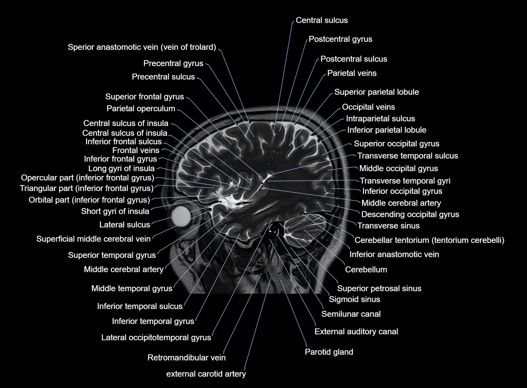 brain sagittal anatomy 3T MRI images -img-00001-00016.webp